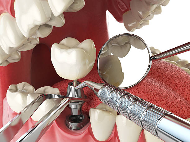 Best Dentist for Dental Trauma  in Rocky Mount, VA